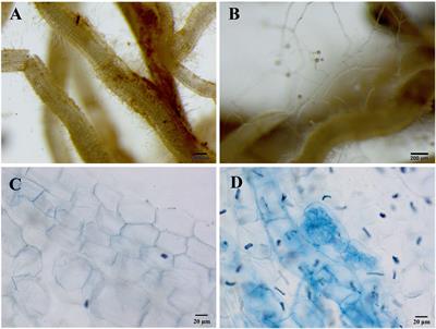 Funneliformis mosseae Enhances Root Development and Pb Phytostabilization in Robinia pseudoacacia in Pb-Contaminated Soil